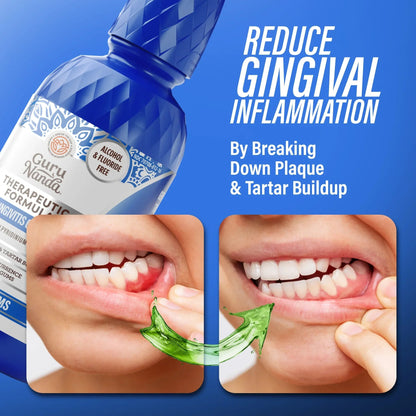 Anti-Gingivitis Oral Rinse ™️